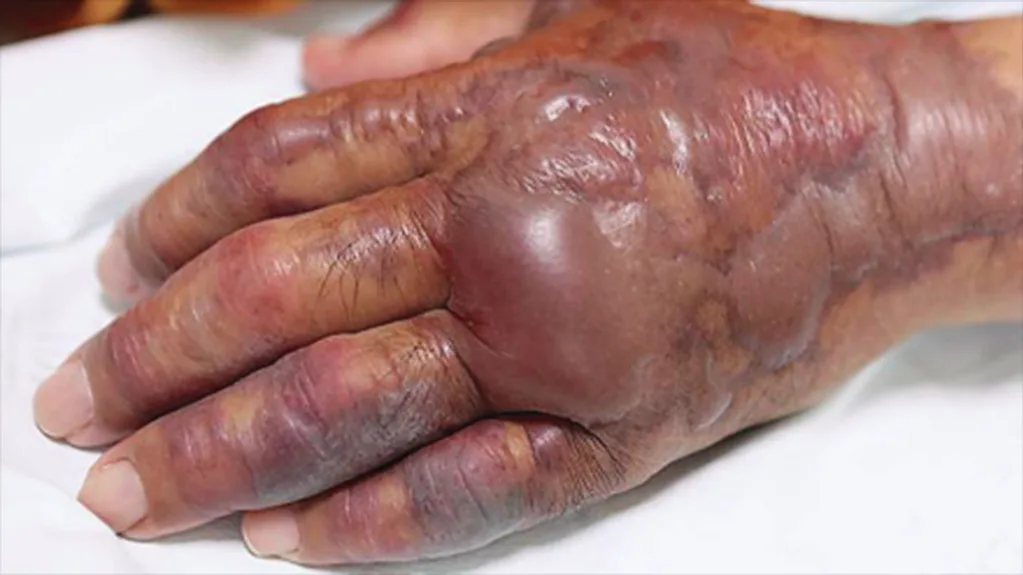 New England Journal of Medicine