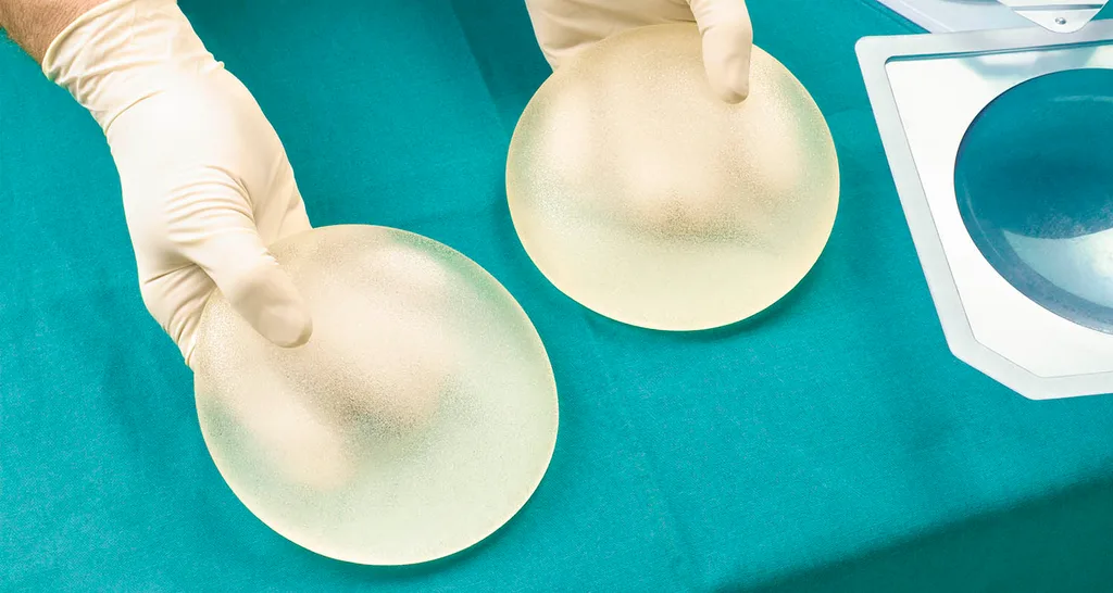 implants
