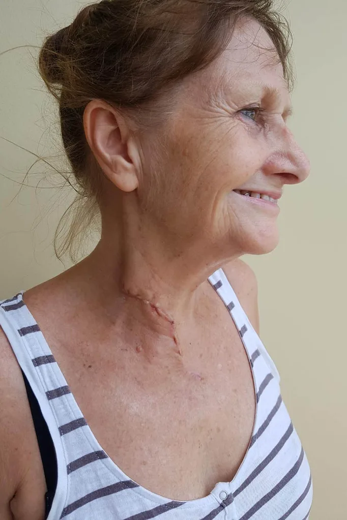 neck attack
