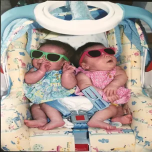 Conjoined twin shock!