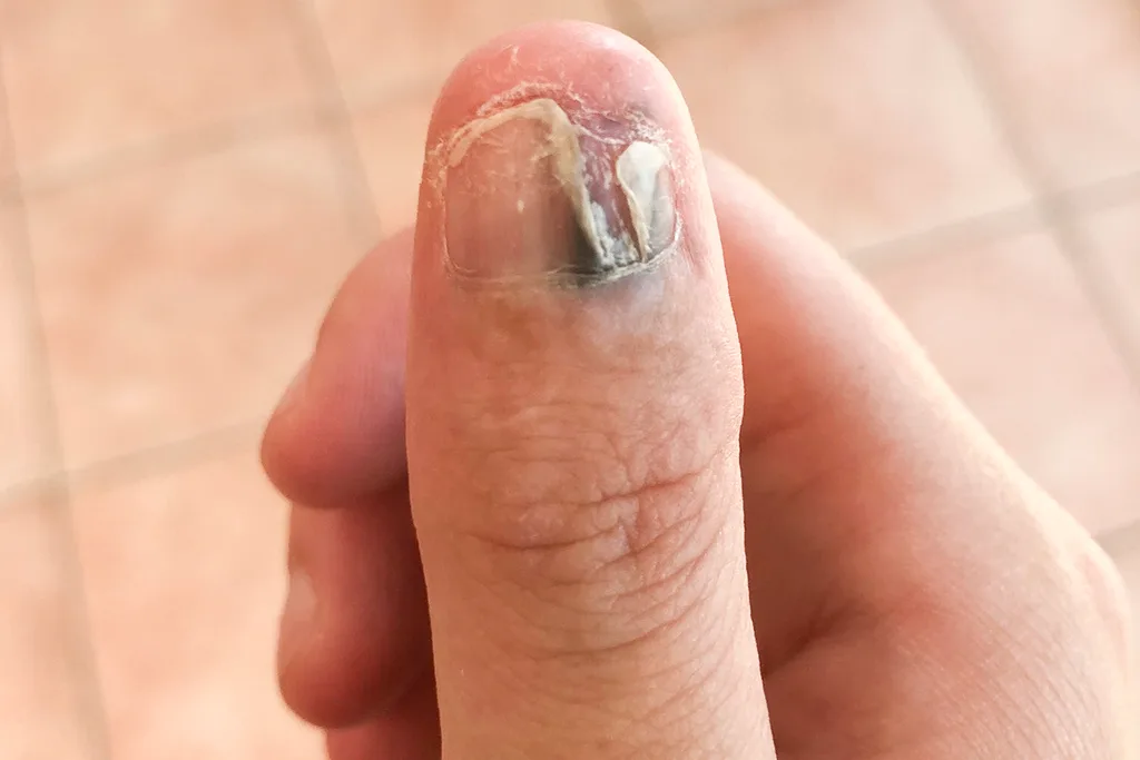 nail