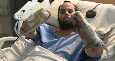 Boxing day horror – I lost my hands and feet