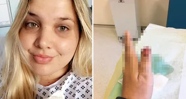 My man bit off my thumb in his sleep – and then swallowed it