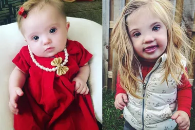 Mum of beautiful toddler with Down syndrome on how she struggled to accept it