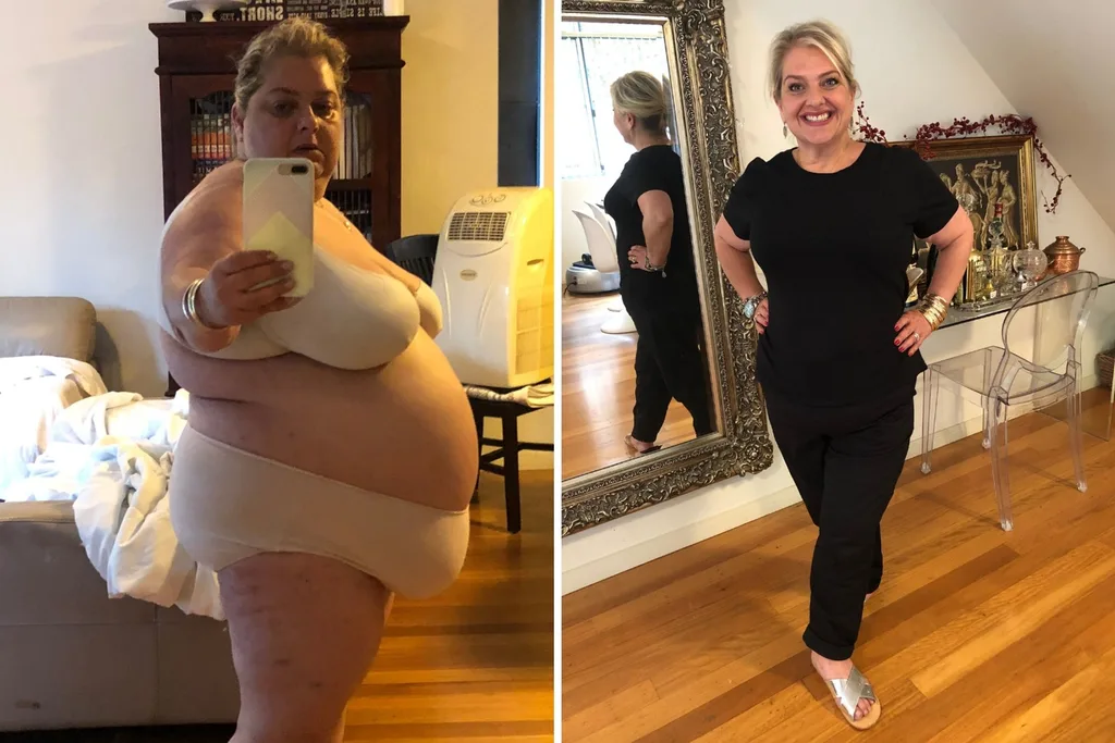 before and after