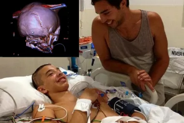 A pole went through my brain – and I SURVIVED