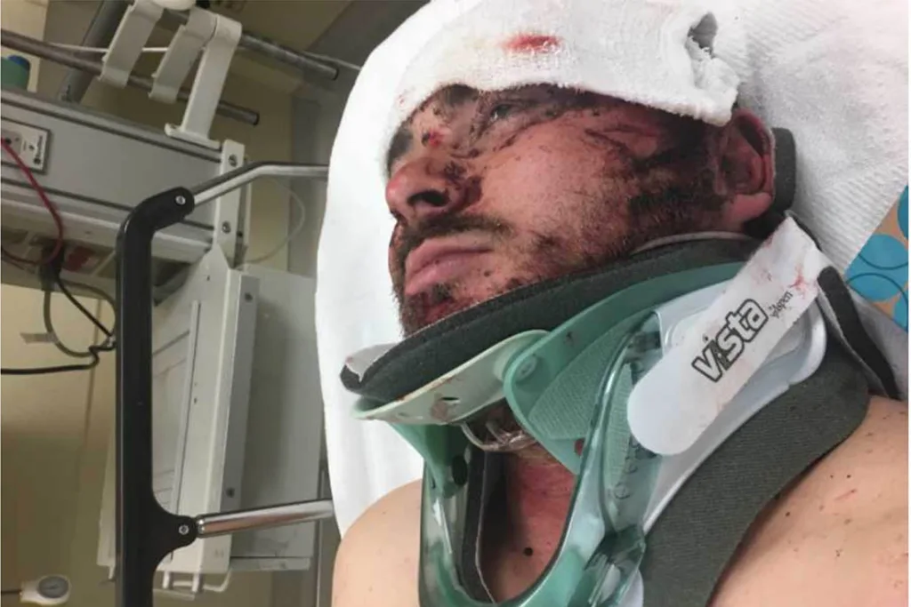Stephen was seriously injured