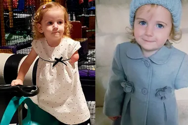 Mum’s cruel comment over baby girl born with no arm