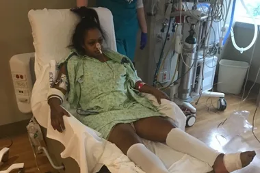 Woman loses ovaries, uterus and TOES after her IUD lodged in her stomach