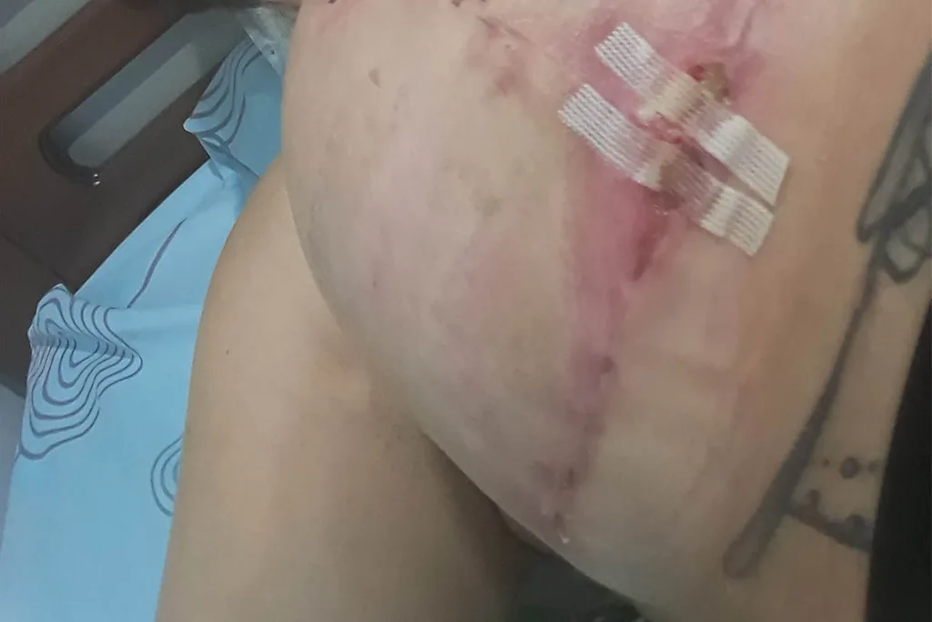 injury