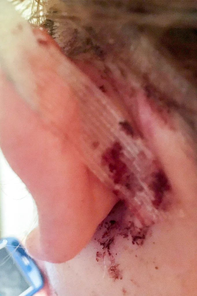 My rotten ear