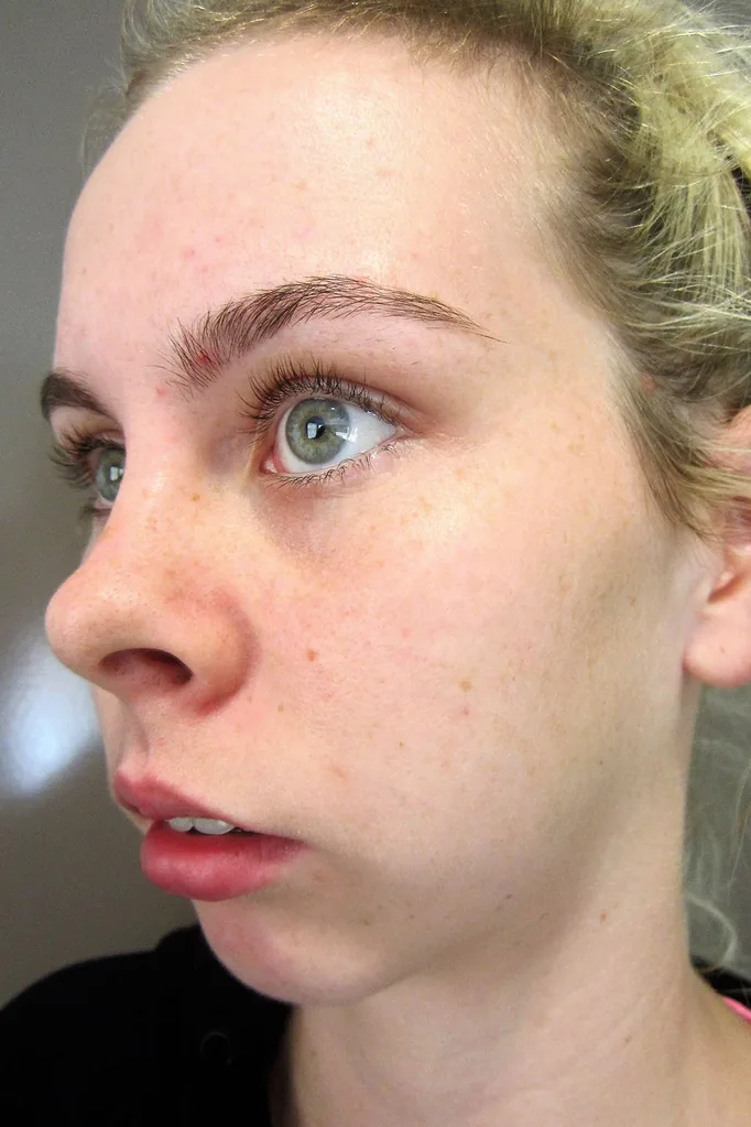 Before the surgery