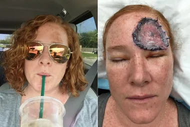 How a freckle did THIS