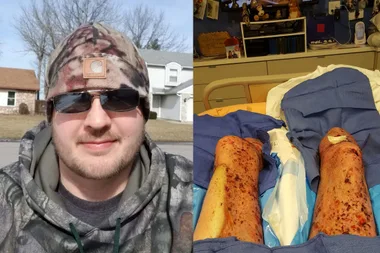 CAR CRASH HORROR: Drink driver crashes his car, loses legs – AND PENIS