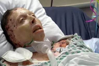 She beat cancer TWICE then her ex did this