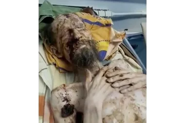 WARNING GRAPHIC CONTENT: Man resembling a mummy is rescued after spending a month trapped in a bear den!