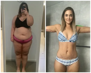 Aussie woman spent $32,000 to wear a bikini