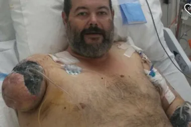 Newcastle man loses his arm in an alleged dog attack