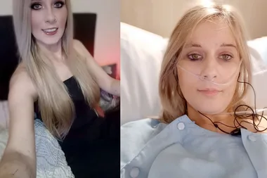 My boob job turned me into a real-life zombie