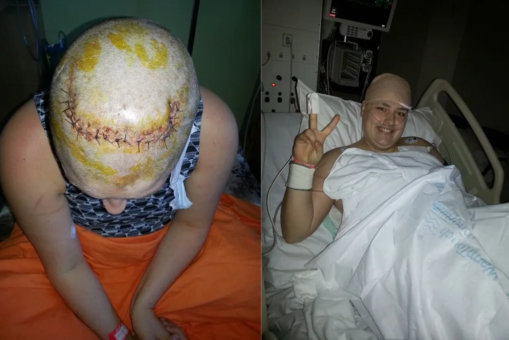 Bianca after surgery