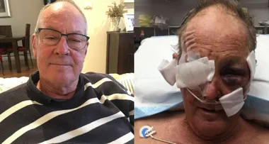 Shot three times – I played dead to survive