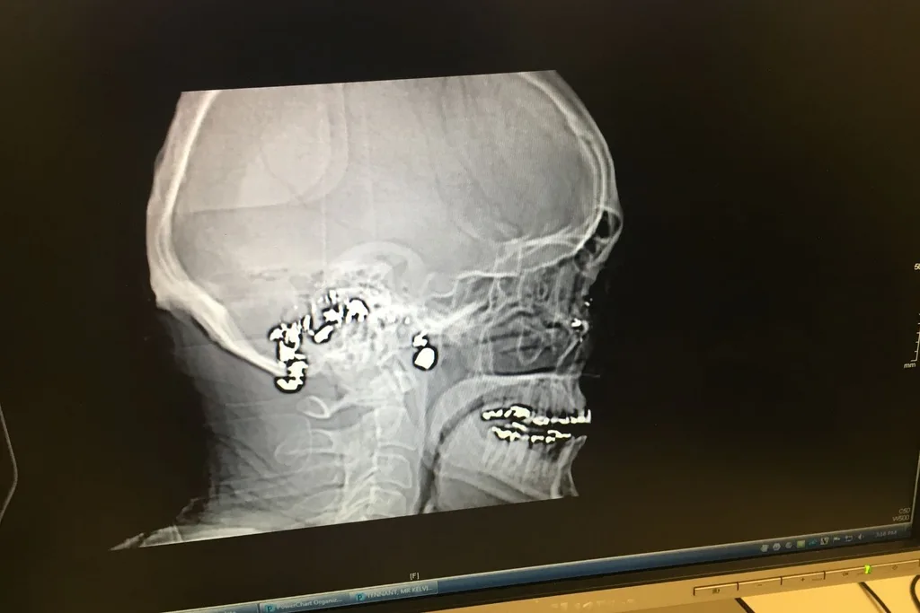 Kelvin Tennant head xray