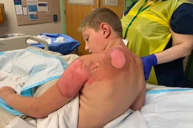 Mum arrested after boy, 11, scalded with boiling water as part of viral Youtube challenge