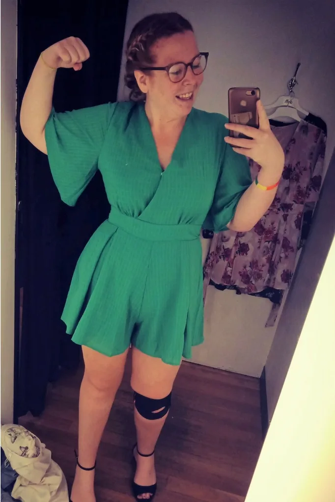 Hannah Bean lost weight naturally before having a gastric sleeve