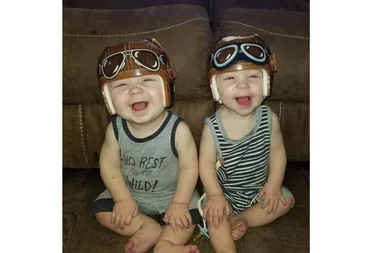 Grandmother designs unique medical helmets for babies