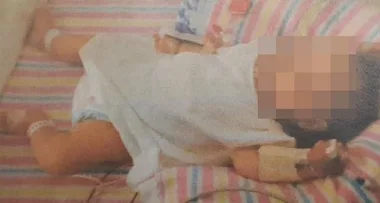 Vegan parents who left their baby so malnourished she had no teeth spared jail