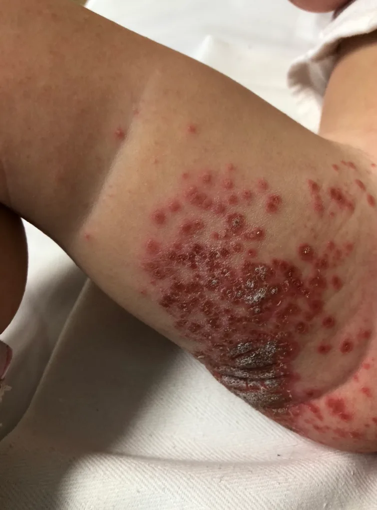 It looked so painful