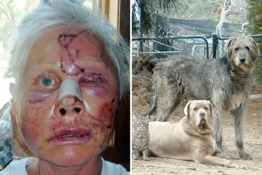 GRAPHIC CONTENT Mum’s epic escape – a bear RIPPED off my face!