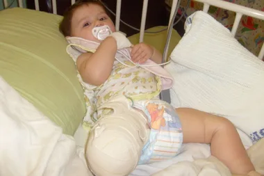 Do we cut off our girl’s leg?