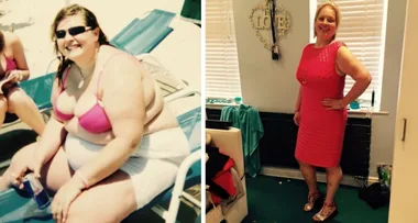 So greedy I had weight-loss surgery TWICE!