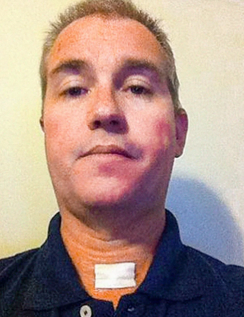 Michael would come in with a bandage on his throat.