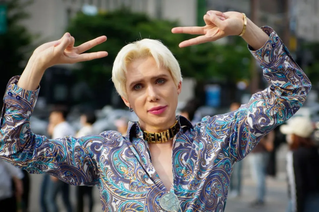 Oli Moon has spent 125,000 GBP to look more like his idol