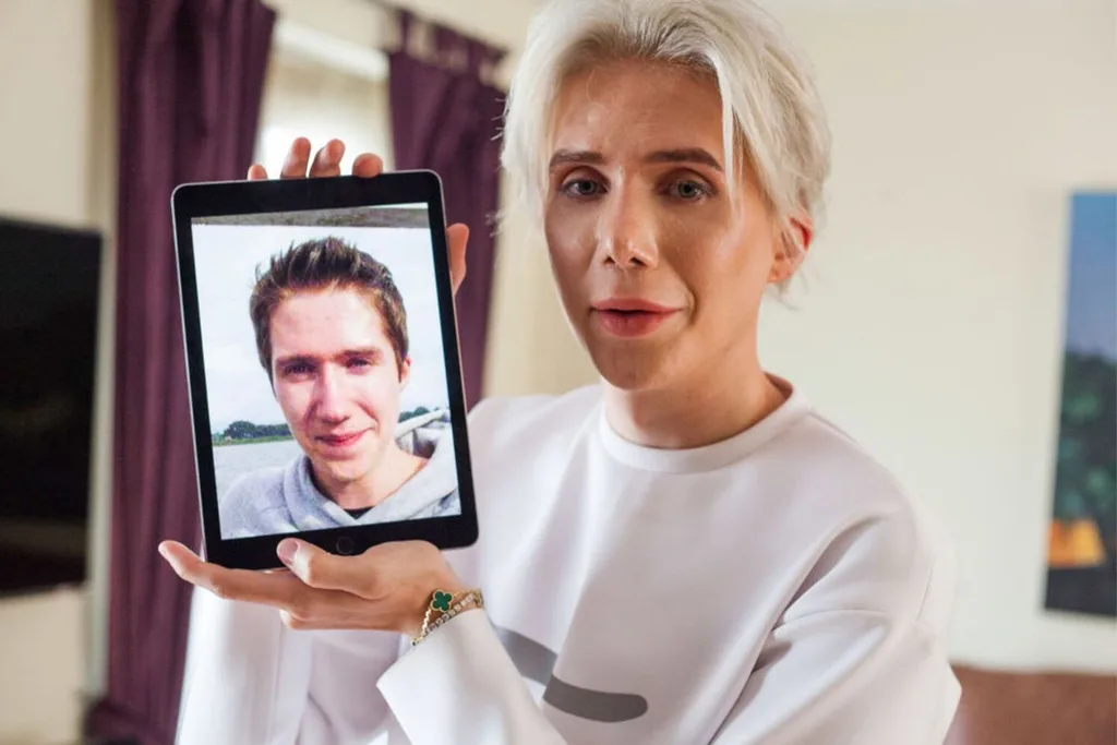 Oli London with a photo before surgery