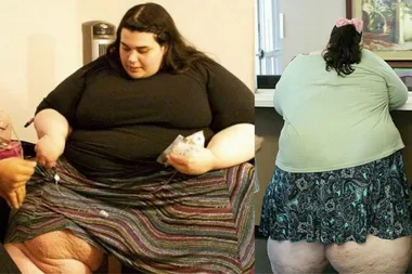 At just 24 Amber tipped the scales at 298kilos – now she’s unrecognisable