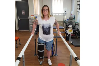 Woman had her leg amputated after her ingrown toenail became infected