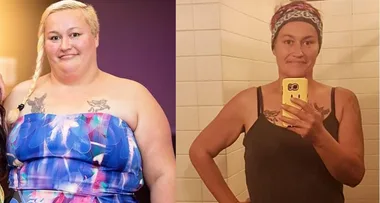 Gastric sleeve hell – I was happier fat!