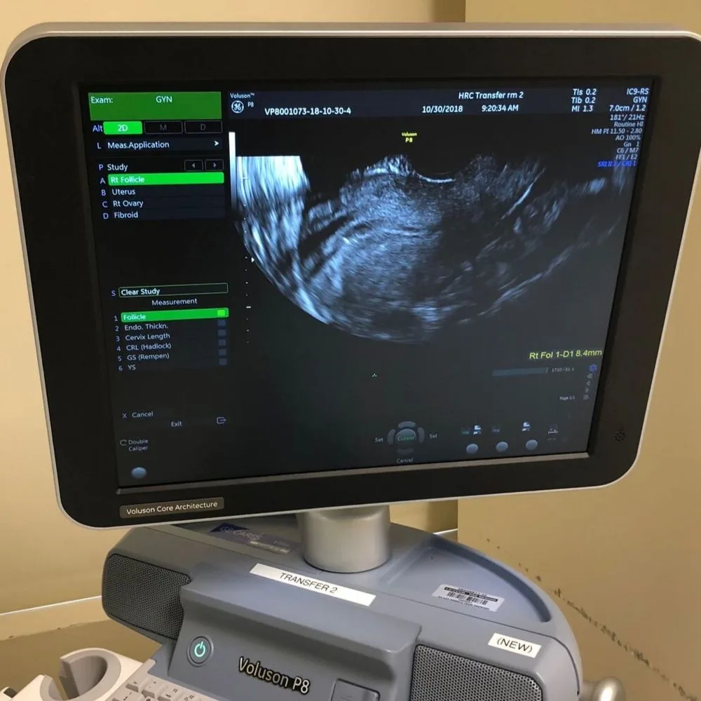 The scan after the transfer