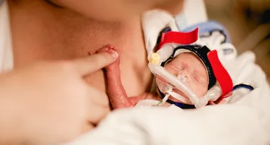 Born at 25 weeks – how would she survive?