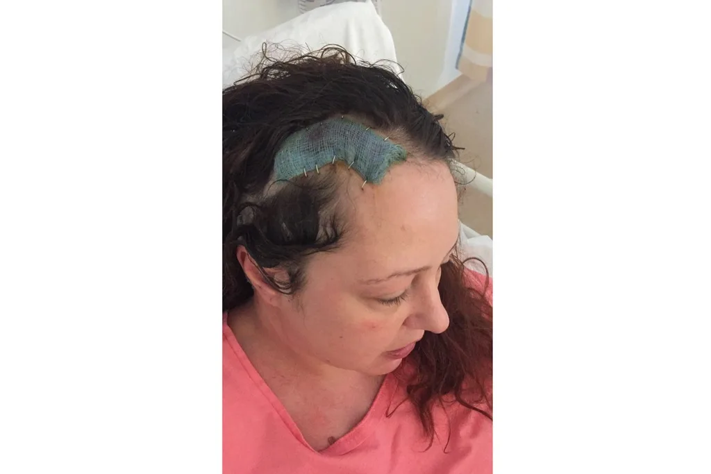 Grace recovering after more brain surgery