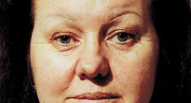 My botched brows cost me $10,000!