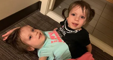 Mum’s vow – why I won’t separate my conjoined twins