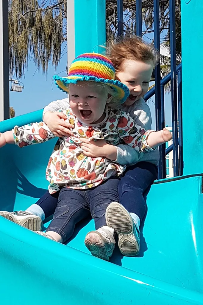 Izabella who was born missing her left hand with her sister Olivia
