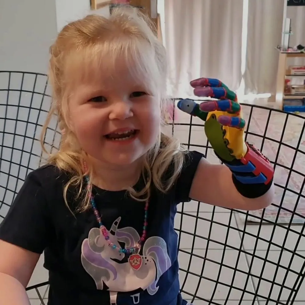 Izabella was born missing a hand.