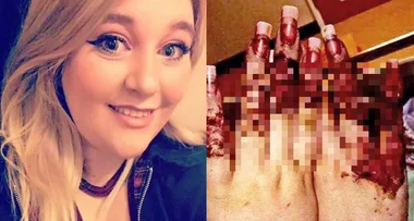 Horror in the kitchen: ‘I roasted myself alive’