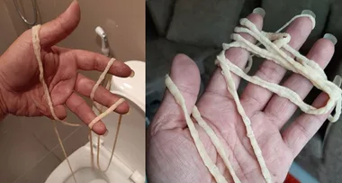Man pulls nine-metre living tapeworm out of his own backside