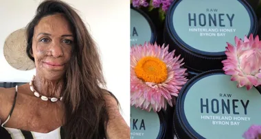 Burns survivor Turia Pitt launches platform to promote local businesses impacted by bushfires